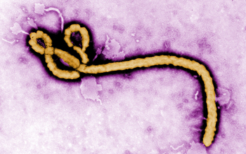 Ebola virus, as seen under a transmission electron microscope.